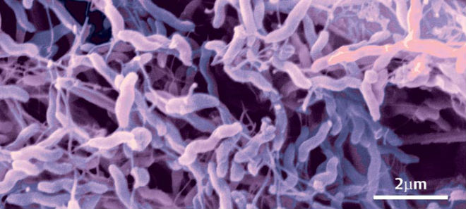 Image of Campylobacter Bacteria