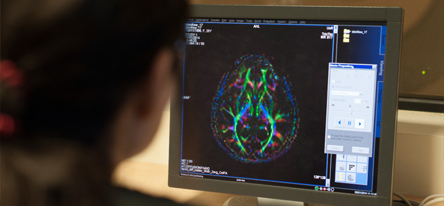 MRI scanner research