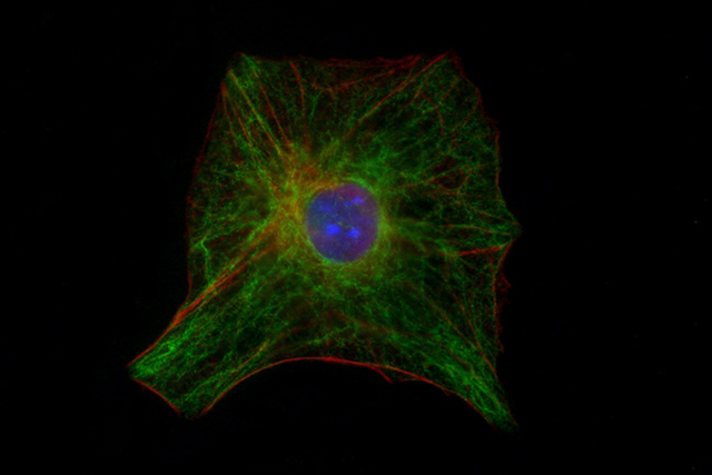 An image of an astrocyte - a type of brain cell
