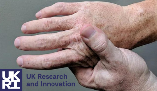Left hand holding right hand in pain. UK RESEARCH AND INNOVATION logo in bottom left corner.