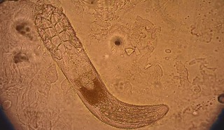 A Demodex folliculorum skin mite under a microscope