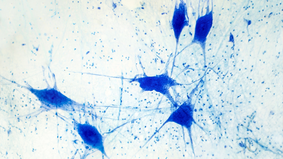 neurons seen under a microscope