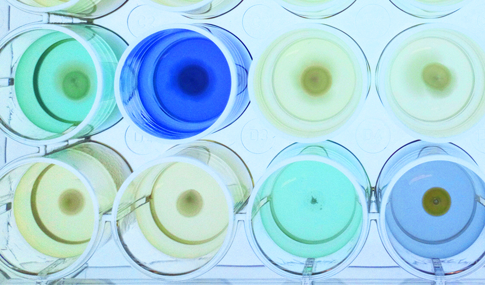 microbiology test samples